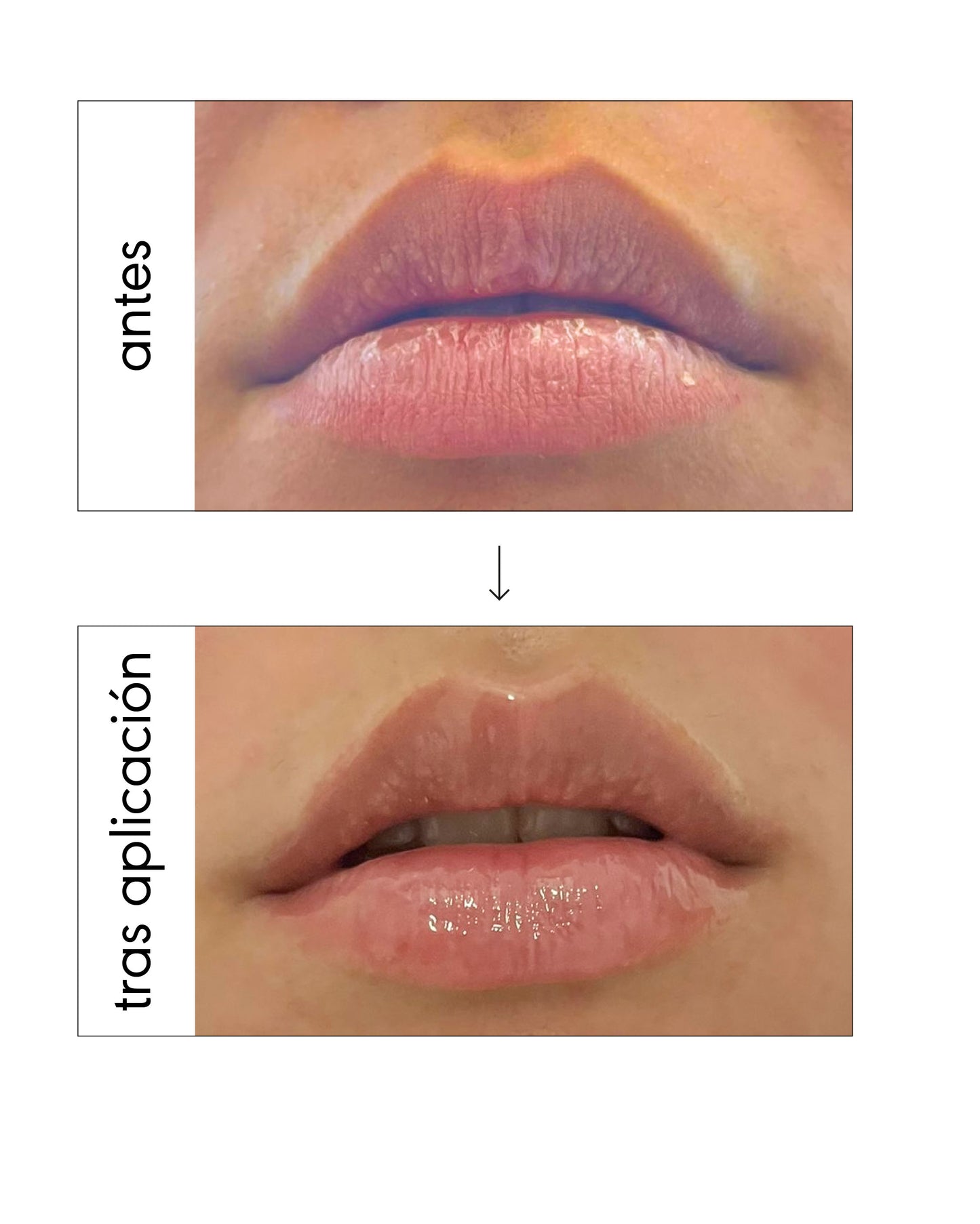 Sos Lip Recovery Mask