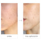 Total cleansing solution