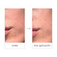 Radiant Renewal Enzymatic Peeling