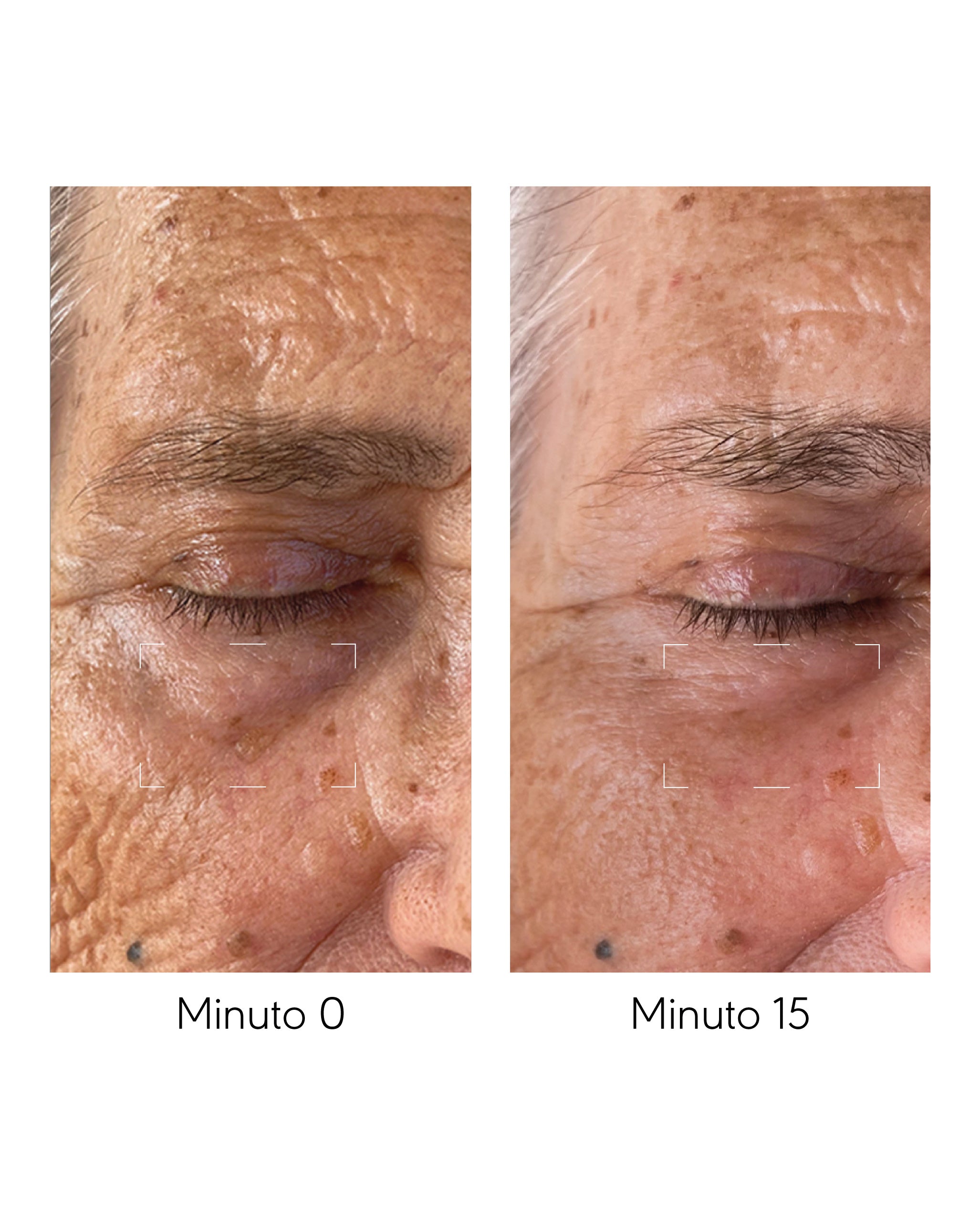 Eye lifting cream