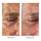 Eye lifting cream